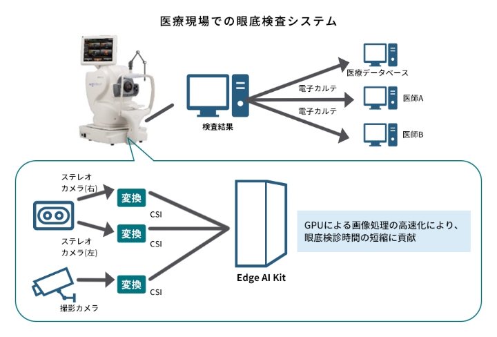 医療現場での眼底検査システムの図